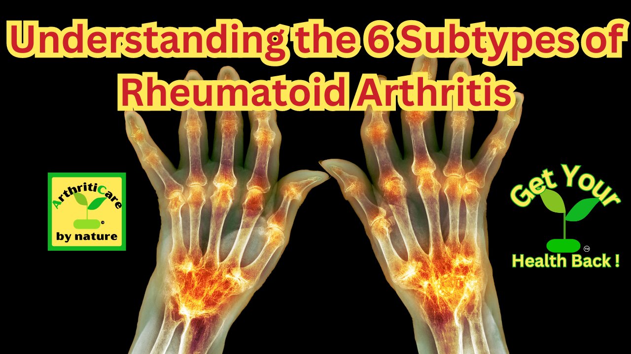 Understanding the 6 Sub-types of Rheumatoid Arthritis - ArthritiCare