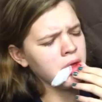 Woman Coming Off Anesthesia Calls Her Dentist A Ho