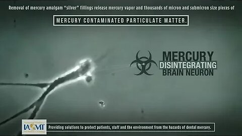 Neurodegeneration -- the Mercury Alzheimer's disease connection