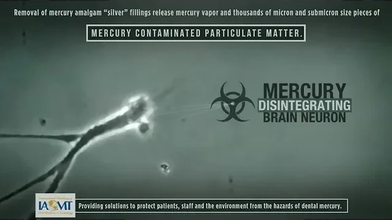 Neurodegeneration -- the Mercury Alzheimer's disease connection