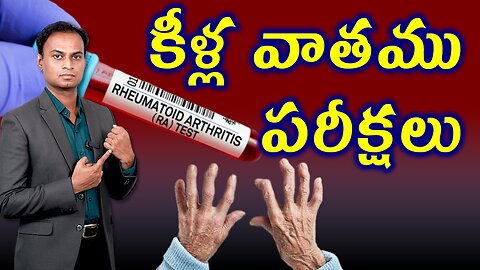 కీళ్ల వాతం కోసం పరీక్షలు | Tests And Investigations For Rheumatoid Arthritis Treatment Cure Solution