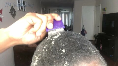 Flaky Dandruff Scratching!