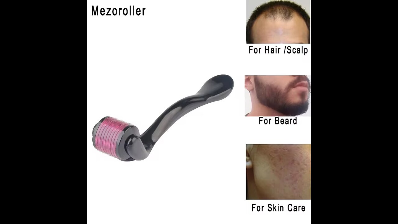 Mezoroller Beard Roller DRS 540 Needles Micro-Needling