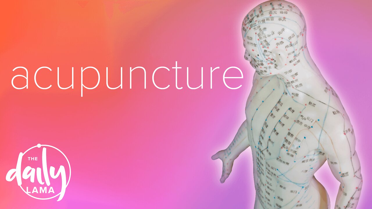 Acupuncture