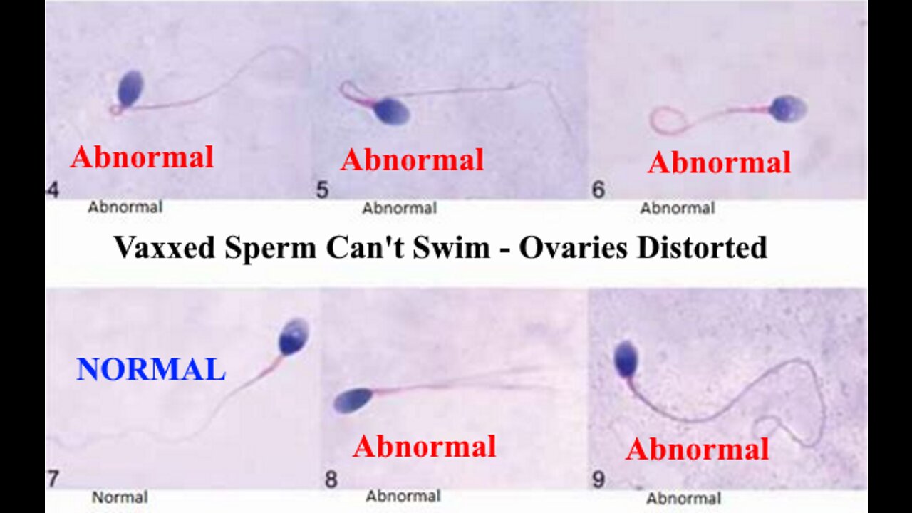 Bad News Can Save Lives - Vaxxed Sperm Can't Swim