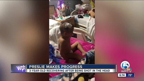 Preslie making progress