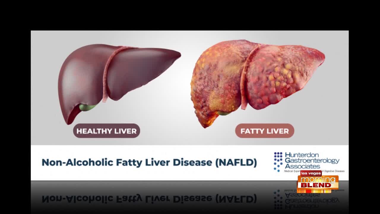 How a Fatty Liver Stops Weight Loss