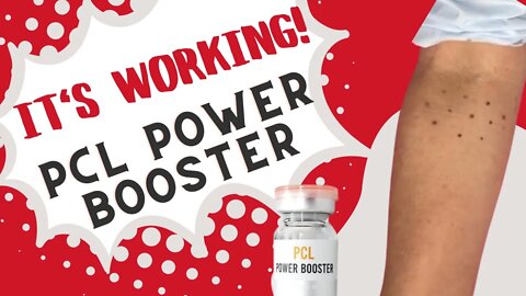 IT WORKS! 🤗 PCL Power Booster for Lower Arm Crepey Skin ~ SASSY10