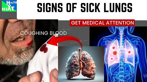 SIGNS YOUR LUNGS IN DANGER