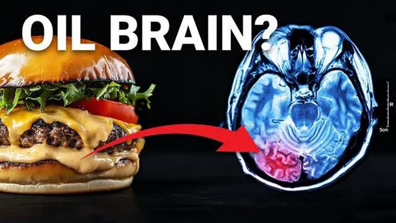 THE 💲212 BILLION DOLLAR FOOD INGREDIENT ☠ POISONING YOUR BRAIN