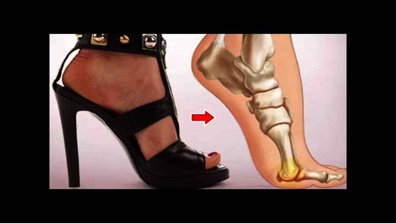 High Heels And Gender Discrimination