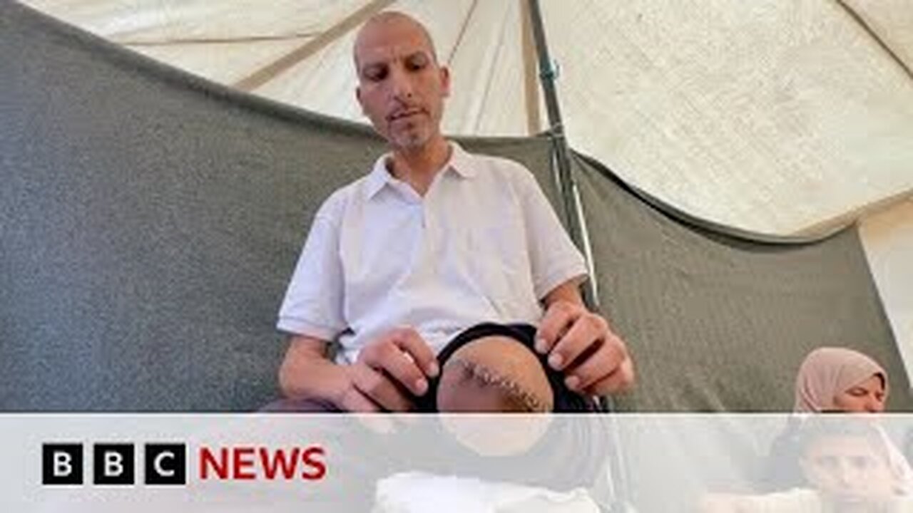 Gazans 'shackled and blindfolded' at Israelhospital, whistle-blowers say | BBC News