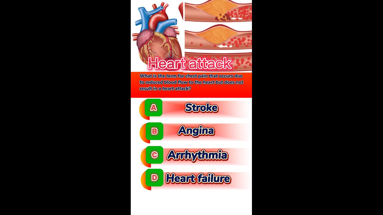 Heart attacks mcqs ,🫀Heart failure question answers #MI #heartbreak heart disease