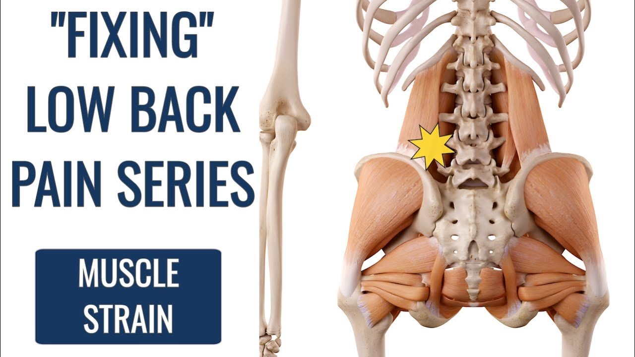 How to Fix Lower Back Strain (DON'T STRETCH)