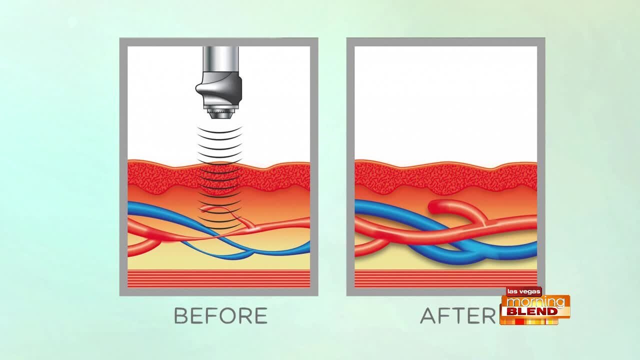 Pain-Free Treatment