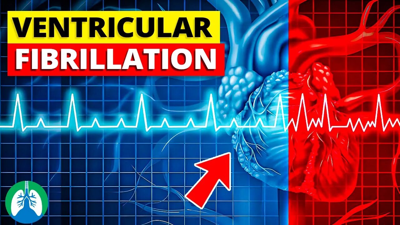 Ventricular Fibrillation (V-fib) | Medical Explainer Video