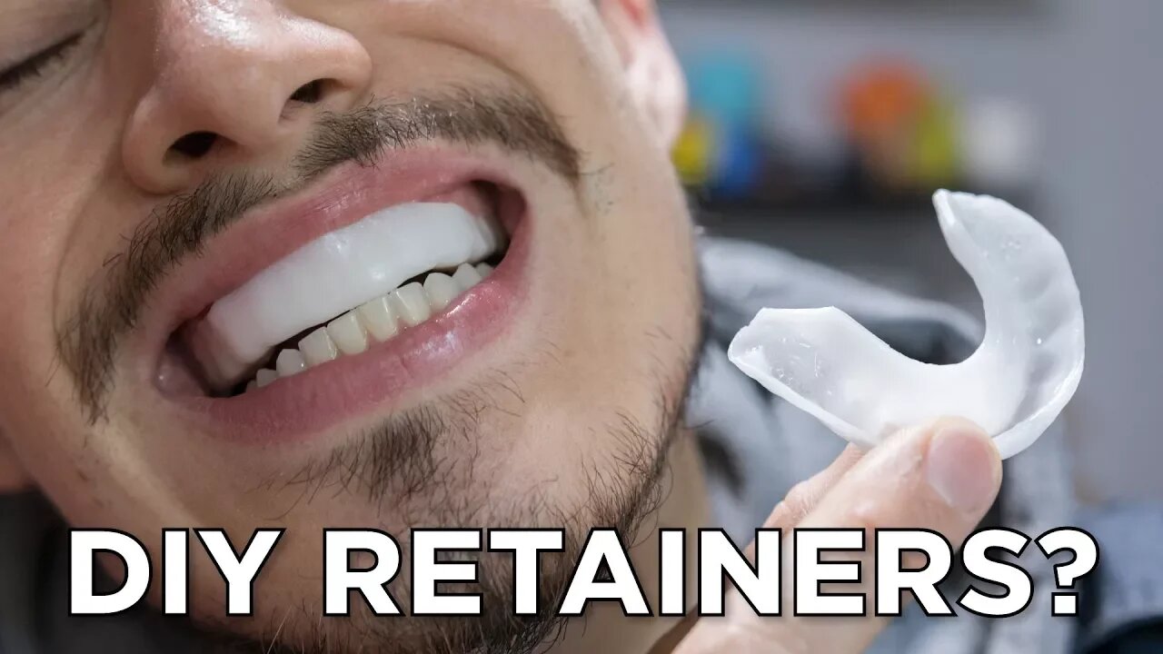 $10 DIY Retainers?! // InstaMorph Moldable Plastic