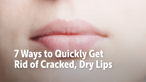 7 Ways to Quickly Get Rid of Cracked, Dry Lips