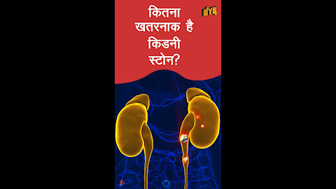 किडनी स्टोन का क्या कारण है *