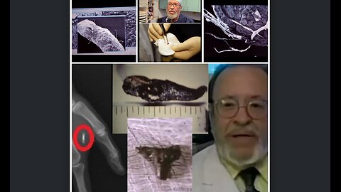 Alien Implant Research of Dr. Roger Leir