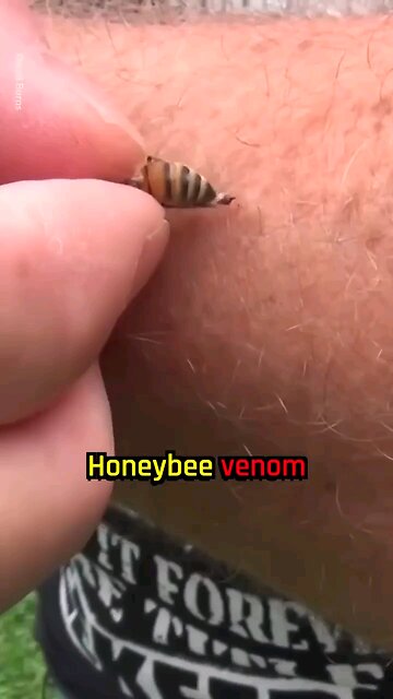 BEE VENOM-Can Aggressively Kill Breast Cancer Cells