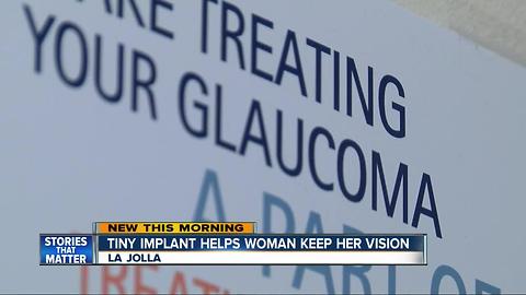 Tiny implant helping San Diego grandmother keep her vision