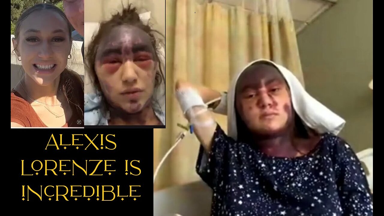 🔥UPDATE: Alexis Lorenze is incredible 🙏 And she's gonna make it! 🙏