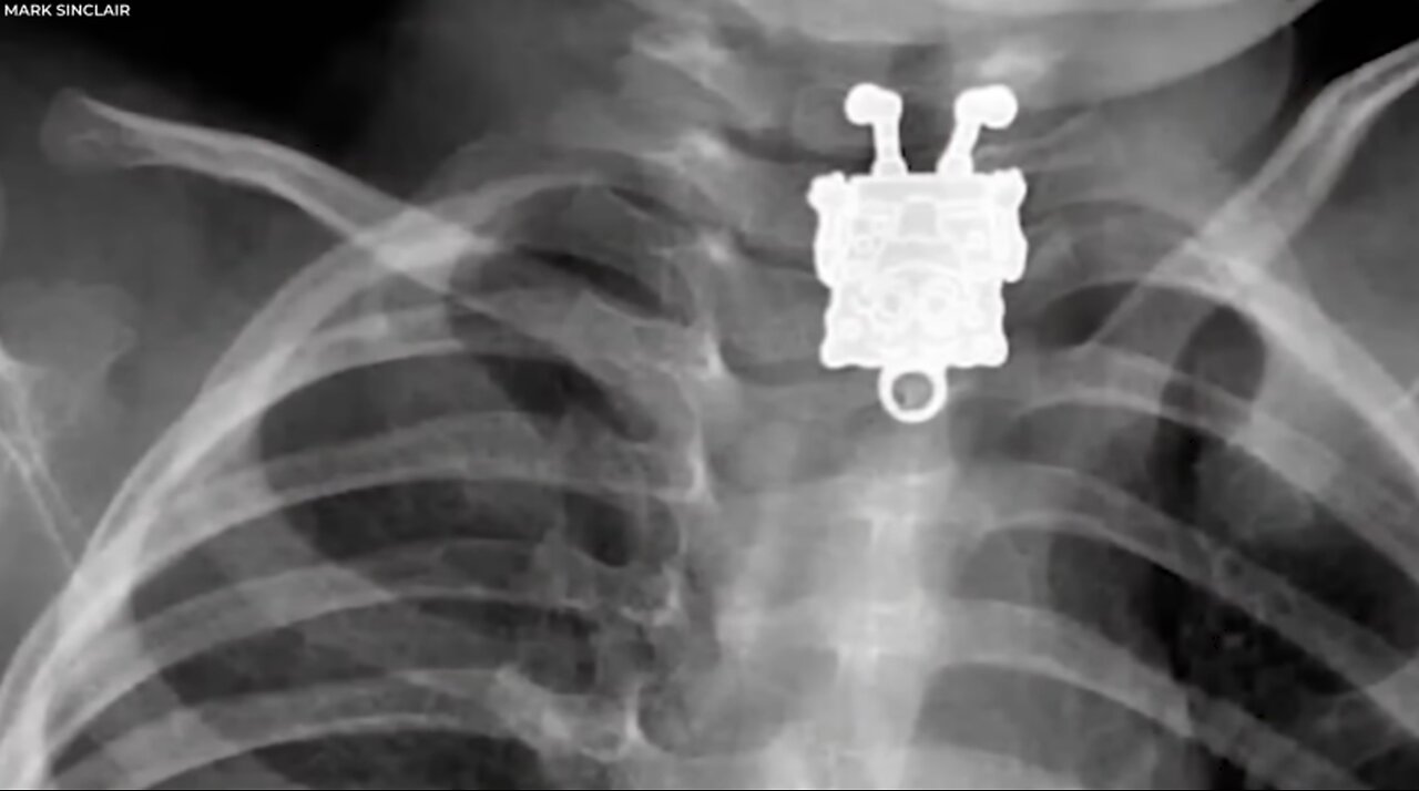 🦴 20 STRANGEST Things Discovered By X Rays 🔍