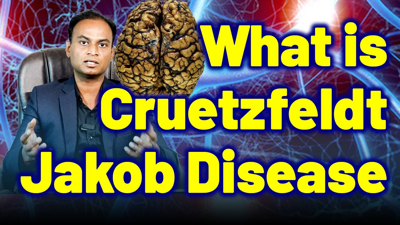 What is Creutzfeldt Jakob Disease Prions Disease MadCowDisease ChronicWastingDisease?Treatment Cure