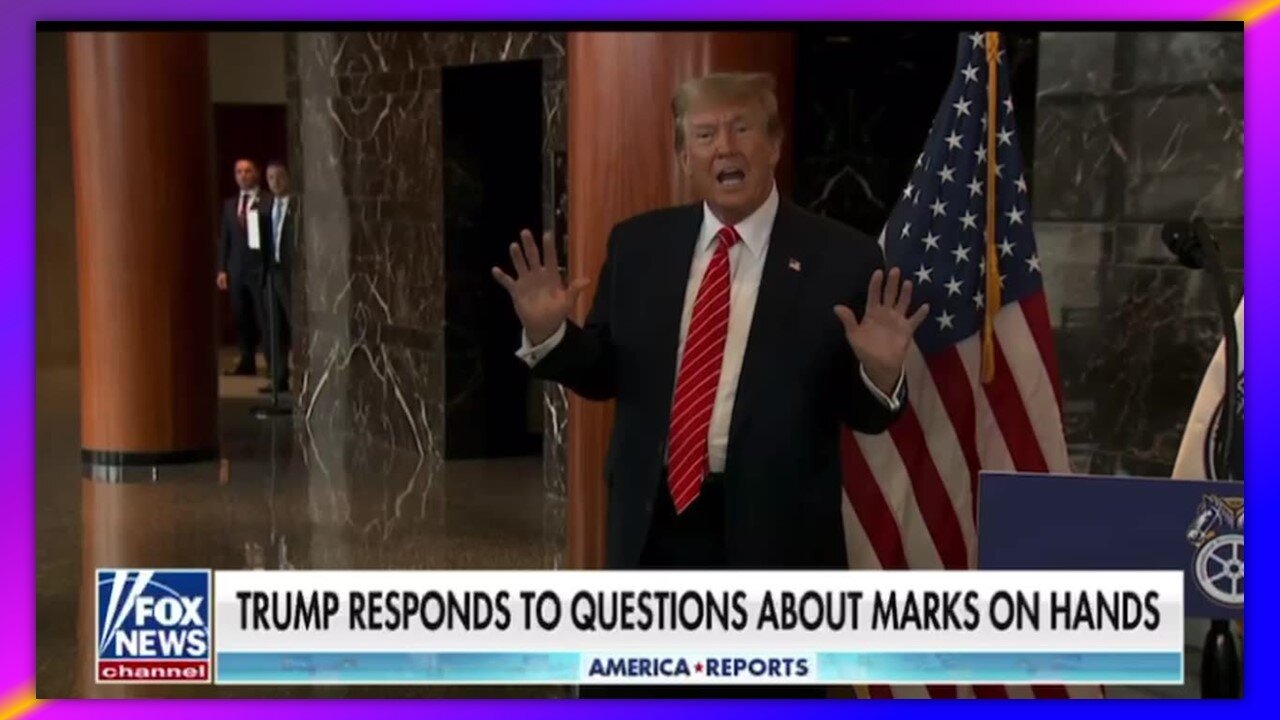 TRUMP ON RED MARKS ON HIS HAND - "MAYBE IT WAS AI?"