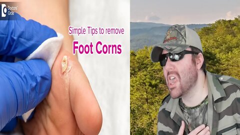 Simple Tips To Get Rid Of Foot Corn - Causes, Symptoms, Treatment-Dr. R Dixit - DC REACTION!! (BBT)