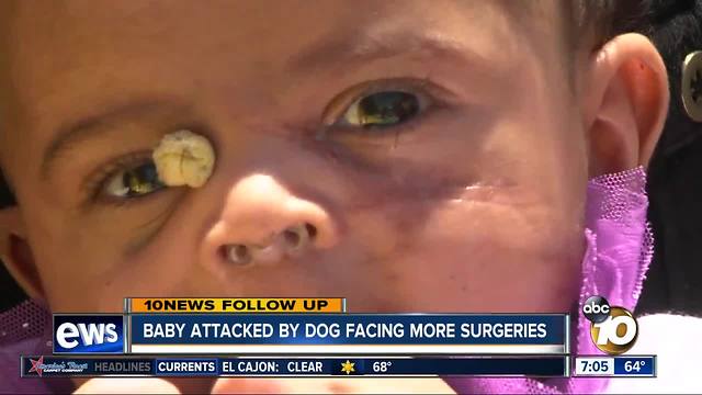 Baby attacked by dog facing more surgeries