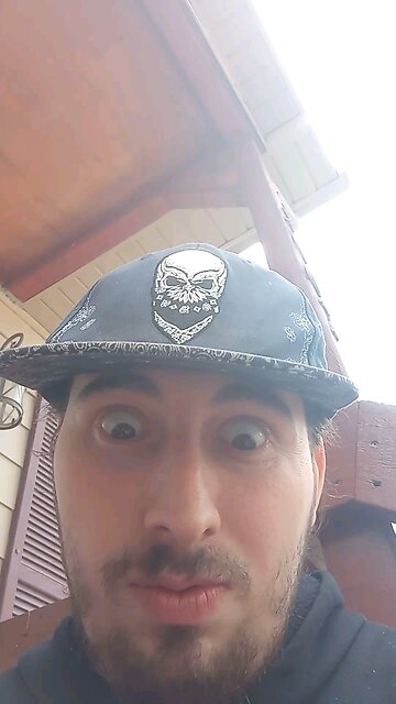 what happened to his eyes