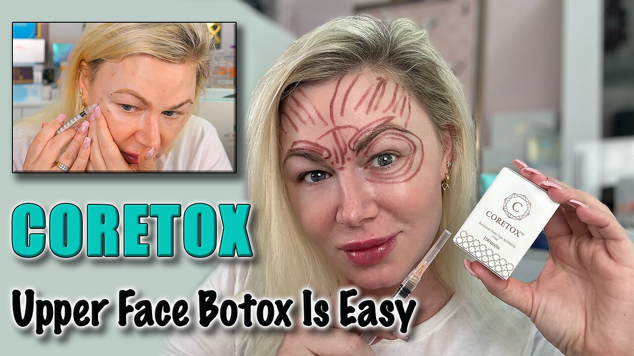 Upper Face Botox is Easy, w Coretox from Maypharm.net, Code Jessica10 Saves you money