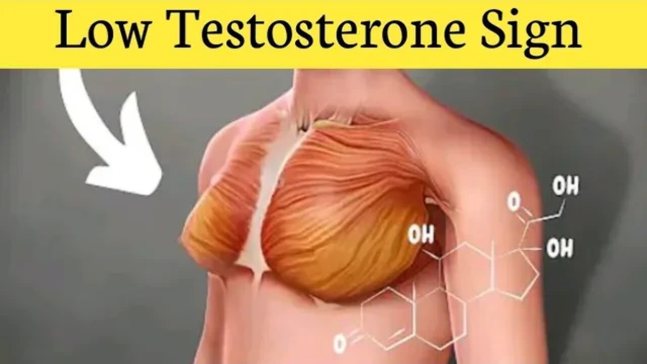 10 Signs You Have Low Testosterone (Low-T)