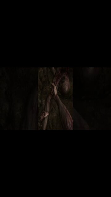 Scorn - I Made The Egg Man My Living Key!