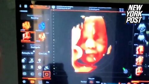 Unborn Baby Smiles at Dad’s Voice Captured on Ultrasound!