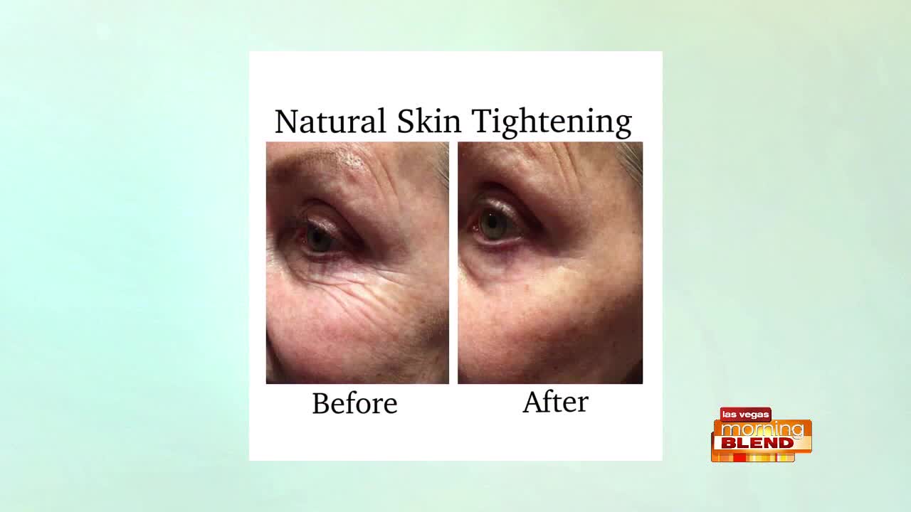 Tighten Sagging Skin