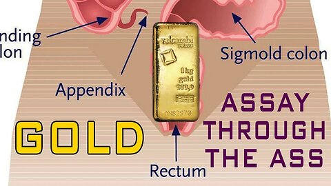 Loan Scammer Helps Me Fight Rectal Gold Smuggling!