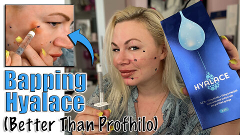 Bapping Hyalace, Better then Profhilo? Let's Test! | Code Jessica10 Saves you Money at AceCosm.com