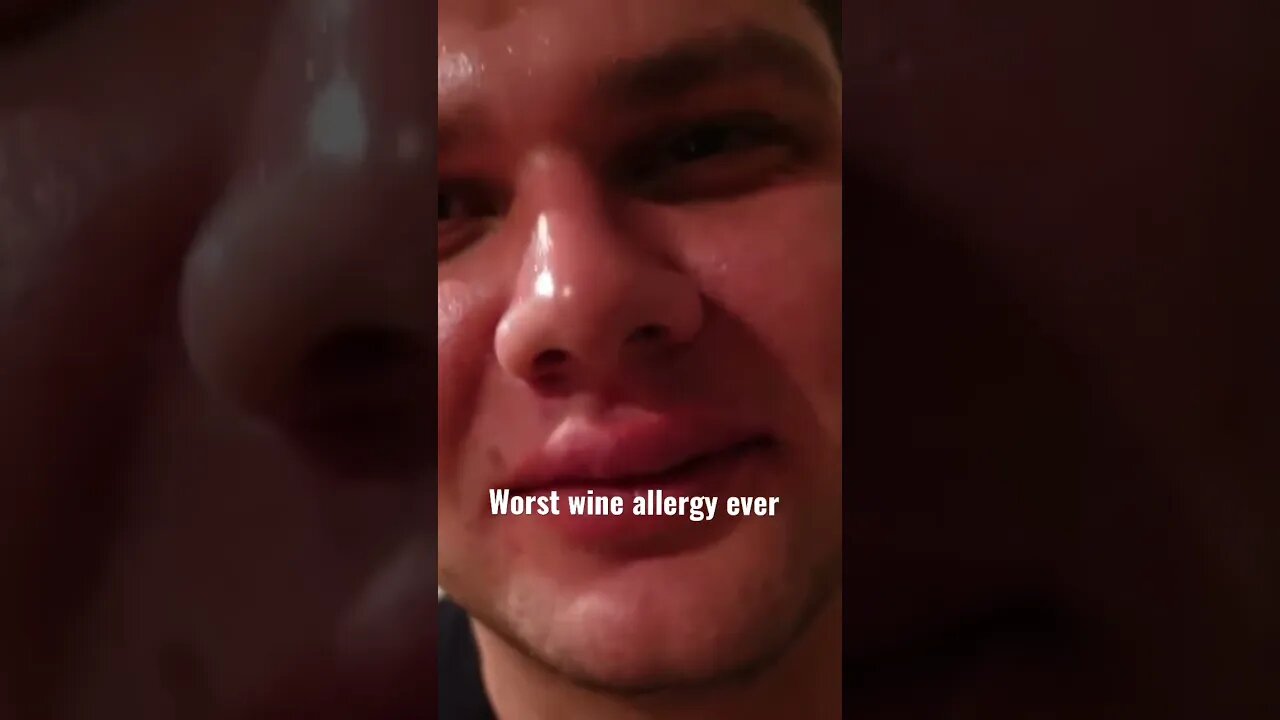 Worst wine allergy ever? Does anyone else get this??