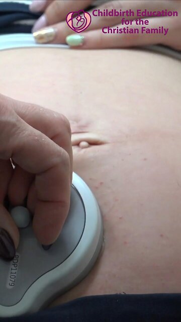 Alternative to Continuous Fetal Monitoring in Labor: Intermittent Auscultation for Low Risk Women