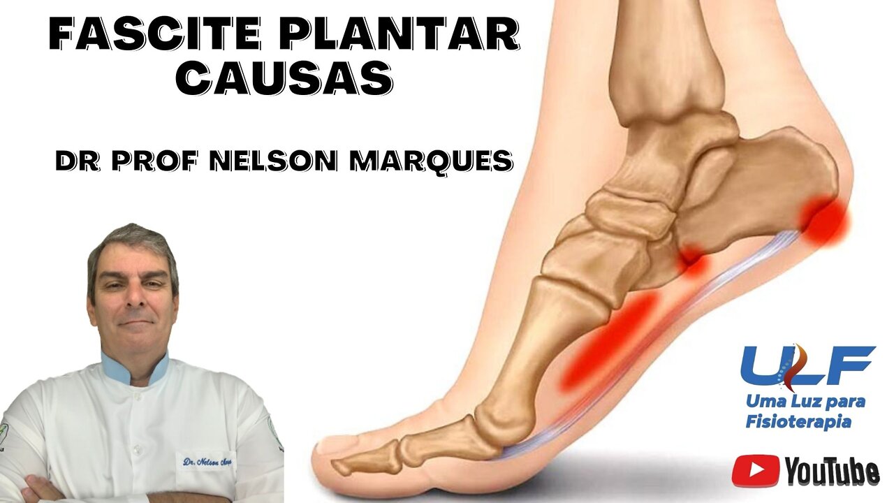 Fascite Plantar - Causas - Dr. Prof. Nelson Marques