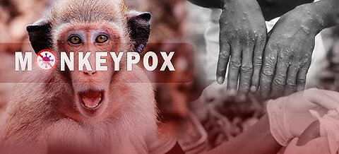 China has started testing people for MonkeyPox