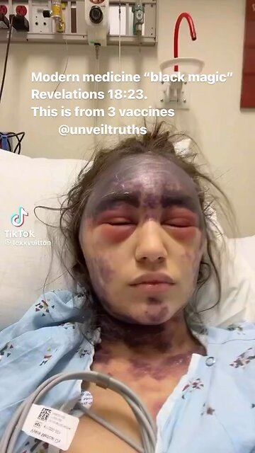 Beware of ALL Vaccines