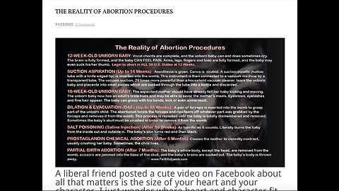 ONE MINUTE for GOD. Hard TRUTH: The REALITY of ABORTION Procedures!