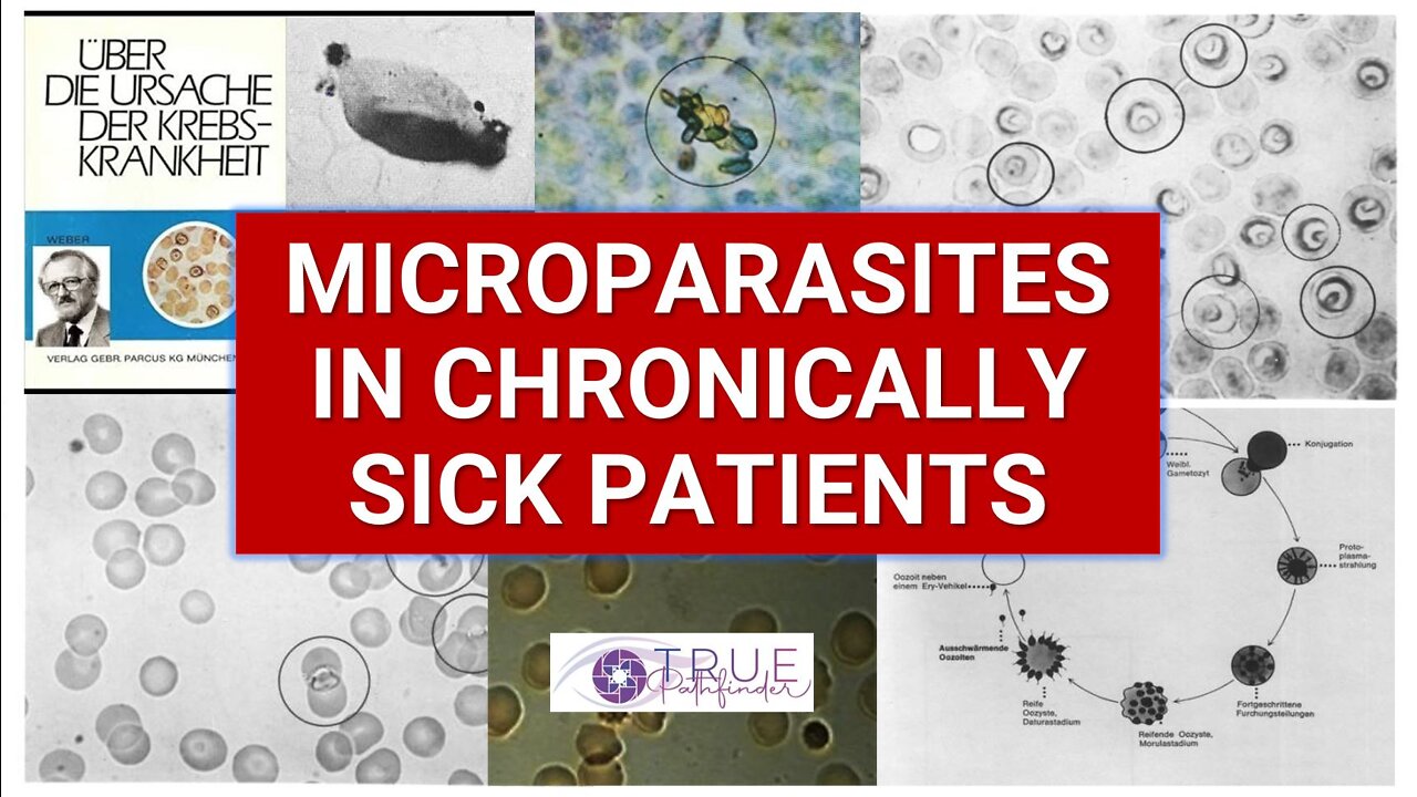 VIDEO PROOF: MICROPARASITES CAUSE CHRONIC DISEASE | TRUE PATHFINDER