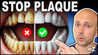 Stop Dental Plaque Forever - Stop Cavities - Easy Solution!