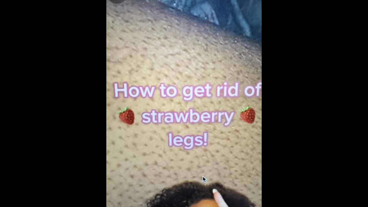 How to get rid of Strawberry 🍓 Legs❤️