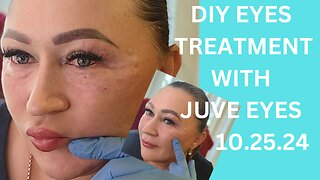 DIY EYES TREATMENT WITH JUVE EYES Polynucleotide 10.25.24 Discount code NAT10